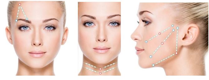 Lifting sans chirurgie Dr Guzman Chirurgien Esthétique à Paris 7